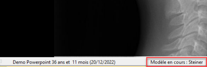 Modele en cours 2.png