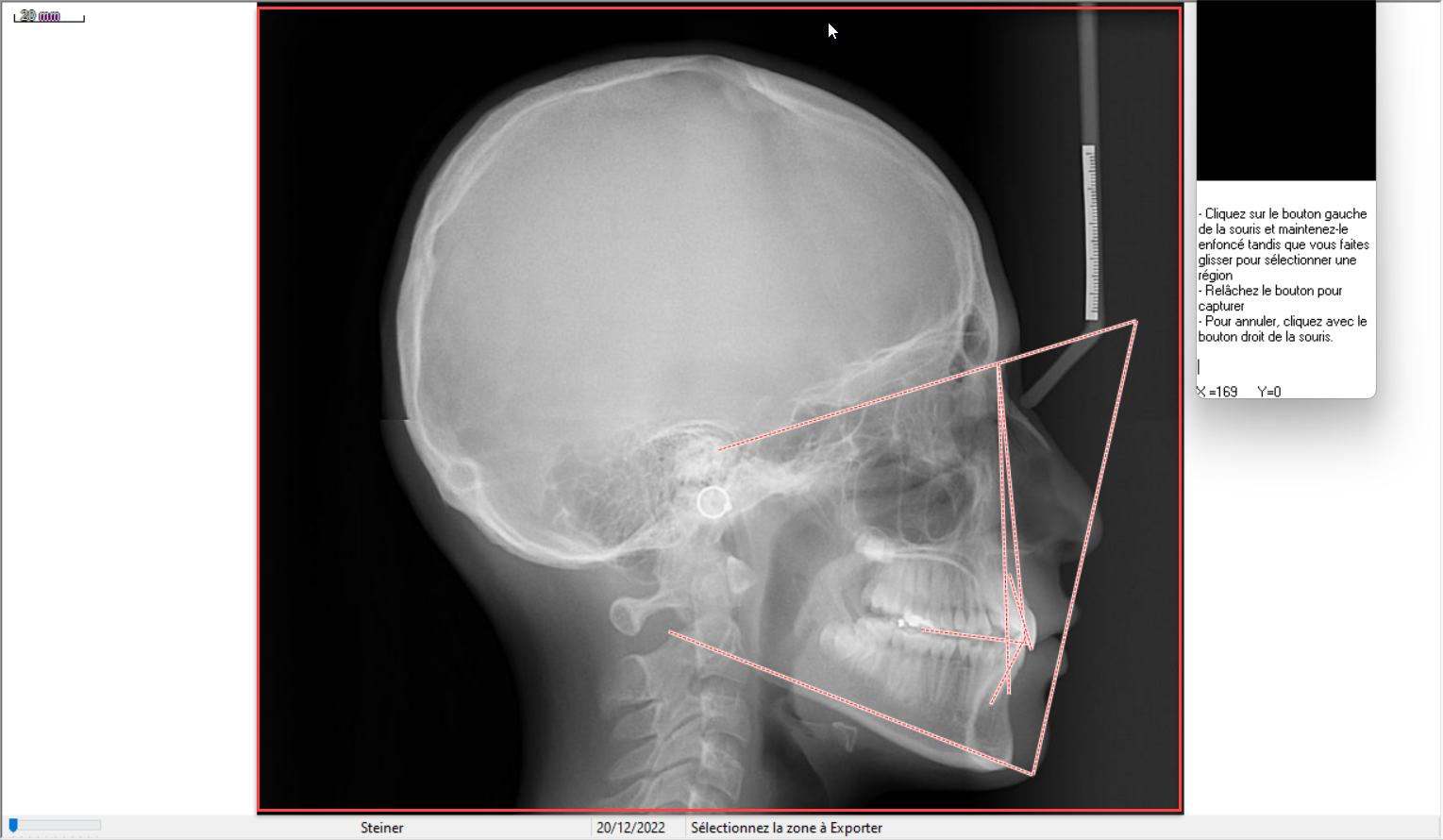 Zone de selection image.png