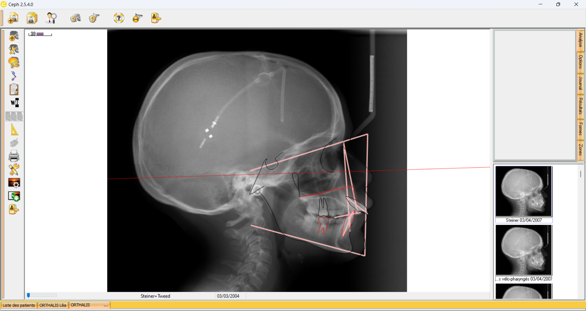 analyse periode 1.png