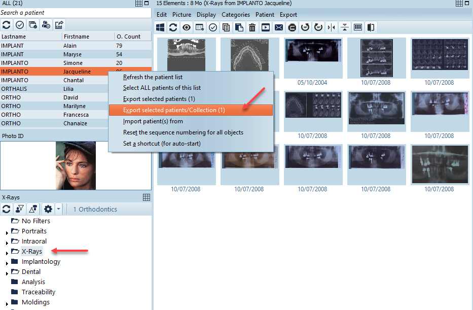 Export_Patient_Collection.png